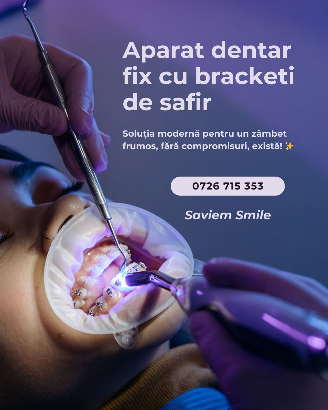 aparat dentar safir